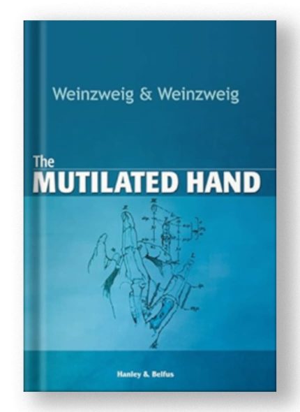 The Mutilated Hand by Norman Weinzweig and Jeffrey Weinzweig