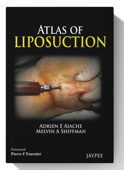 Atlas of Liposuction