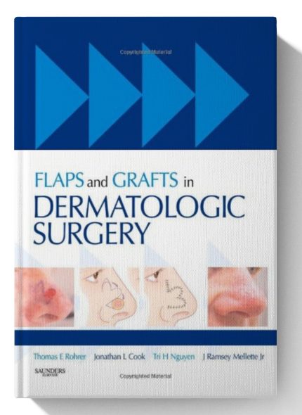 Flaps and Grafts in Dermatologic Surgery