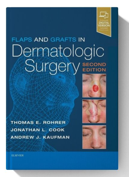 Flaps and Grafts in Dermatologic Surgery
