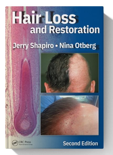Hair Loss and Restoration