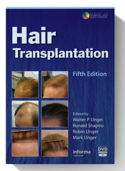 Hair Transplantation