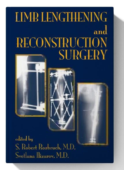 Limb Lengthening and Reconstruction Surgery