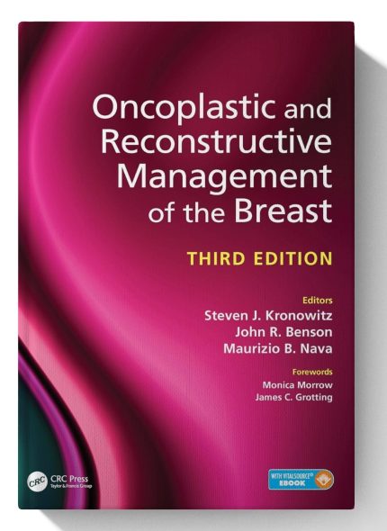 Oncoplastic and Reconstructive Management of the Breast, Third Edition