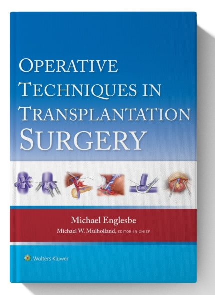 Operative Techniques in Transplantation Surgery