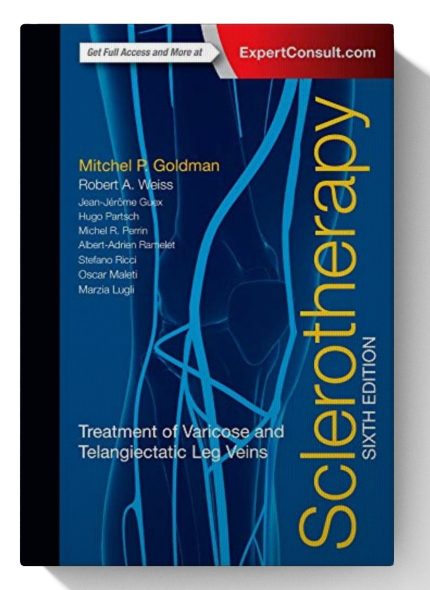 Sclerotherapy: Treatment of Varicose and Telangiectatic Leg Veins