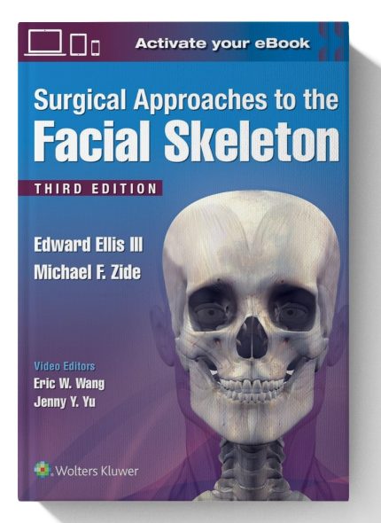 Surgical Approaches to the Facial Skeleton