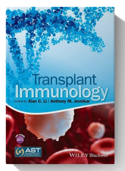 Transplant Immunology