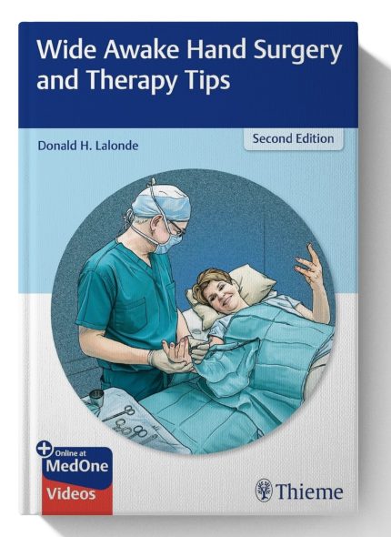 Wide Awake Hand Surgery and Therapy Tips