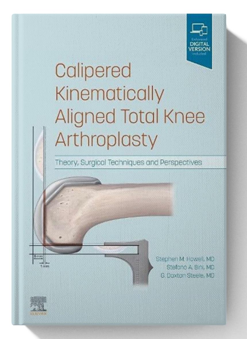 Calipered Kinematically aligned Total Knee Arthroplasty: Theory, Surgical Techniques and Perspectives