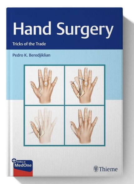 Hand Surgery: Tricks of the Trade
