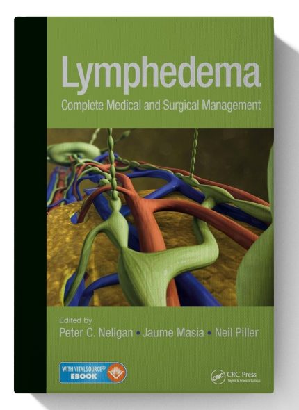 Lymphedema: Complete Medical and Surgical Management