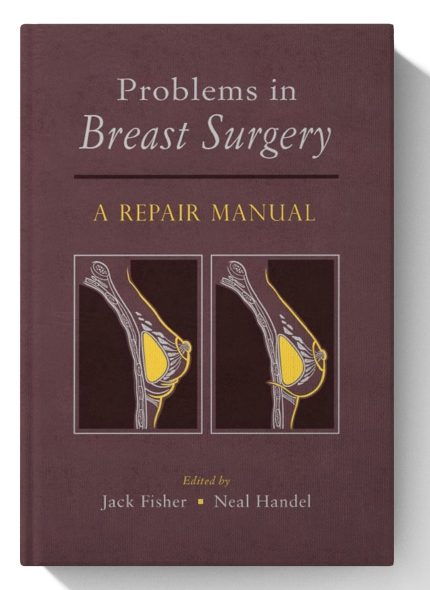 Problems in Breast Surgery: A Repair Manual
