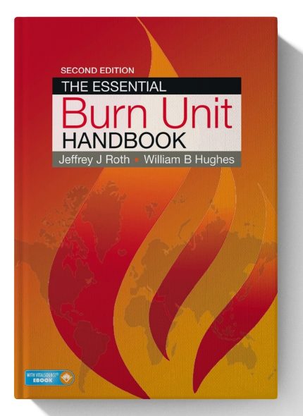 The Essential Burn Unit Handbook