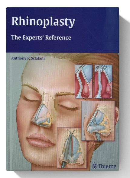 Rhinoplasty: The Experts' Reference