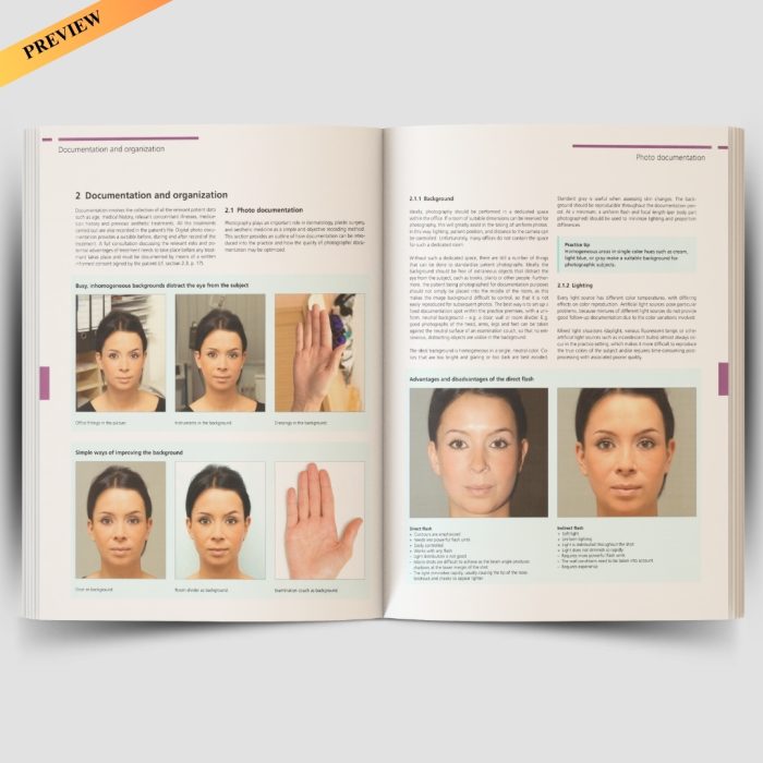 Illustrated Guide to Aesthetic Botulinum Toxin Injections: Basics / Localization / Uses (Aesthetic Methods for Skin Rejuvenation) - Image 3