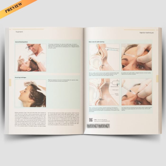 Illustrated Guide to Aesthetic Botulinum Toxin Injections: Basics / Localization / Uses (Aesthetic Methods for Skin Rejuvenation) - Image 6