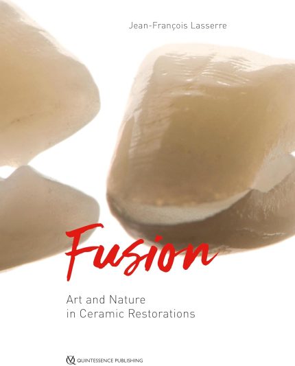 Fusion: Art and Nature in Ceramic Restorations