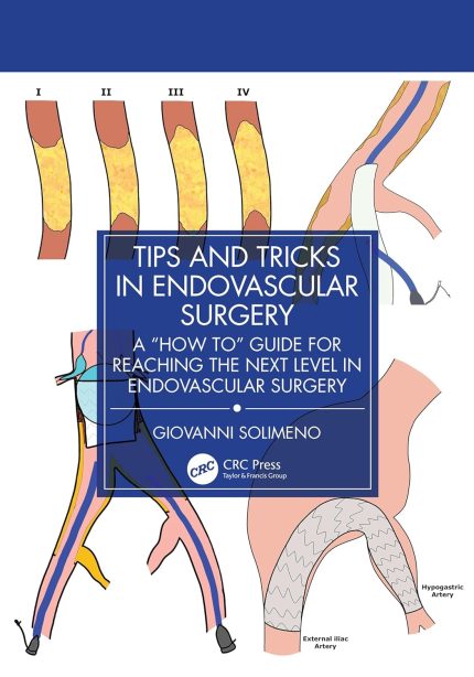 Tips and Tricks in Endovascular Surgery: A "How to" Guide for reaching the next Level in Endovascular Surgery