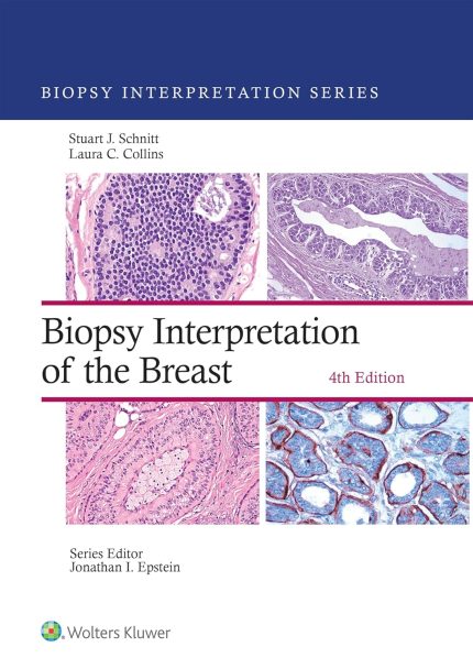 Biopsy Interpretation of the Breast: eBook without Multimedia (Biopsy Interpretation Series)