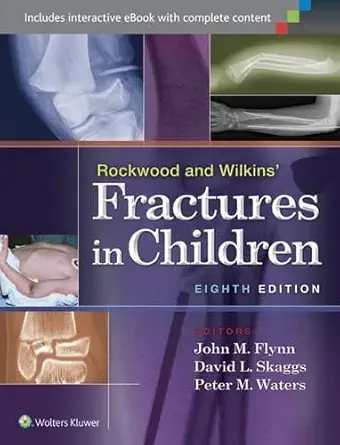 Rockwood and Wilkins' Fractures in Children