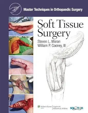 Soft Tissue Surgery (Master Techniques in Orthopaedic Surgery)