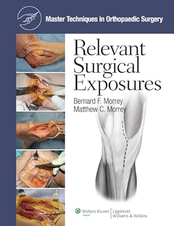 Relevant Surgical Exposures (Master Techniques in Orthopaedic Surgery)