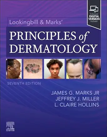 Lookingbill & Marks’ Principles of Dermatology