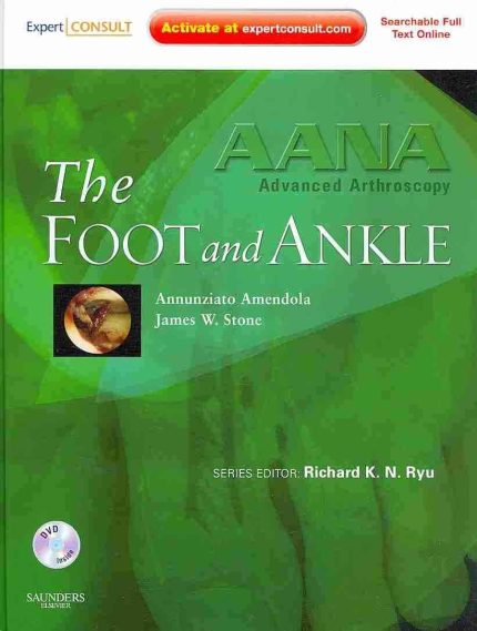 AANA Advanced Arthroscopy: The Foot and Ankle: Expert Consult