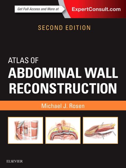 Atlas of Abdominal Wall Reconstruction: Expert Consult