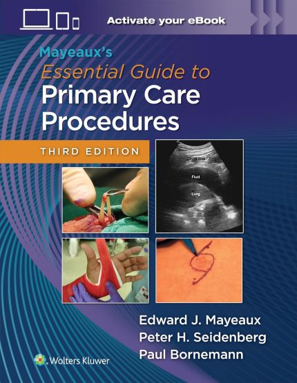 Mayeaux's Essential Guide to Primary Care Procedures