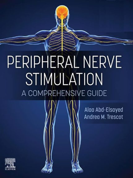 Peripheral Nerve Stimulation - E-Book: A Comprehensive Guide