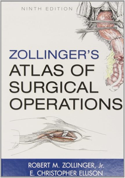 Zollinger's Atlas of Surgical Operations, 9th Edition