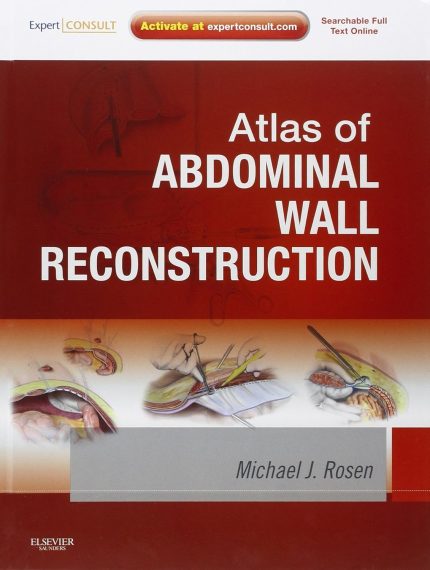 Atlas of Abdominal Wall Reconstruction: Expert Consult
