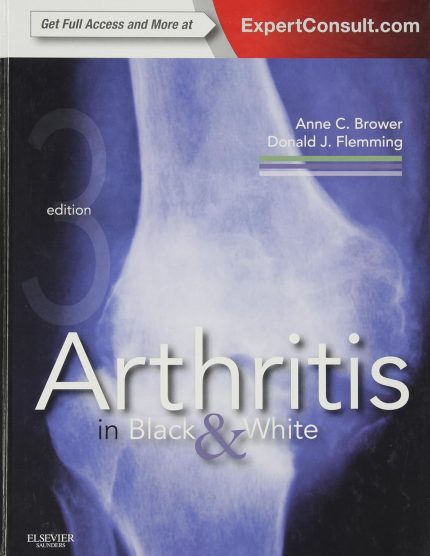 Arthritis in Black and White