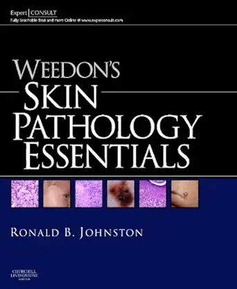 Weedon's Skin Pathology Essentials: Expert Consult