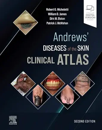 Andrews' Diseases of the Skin Clinical Atlas