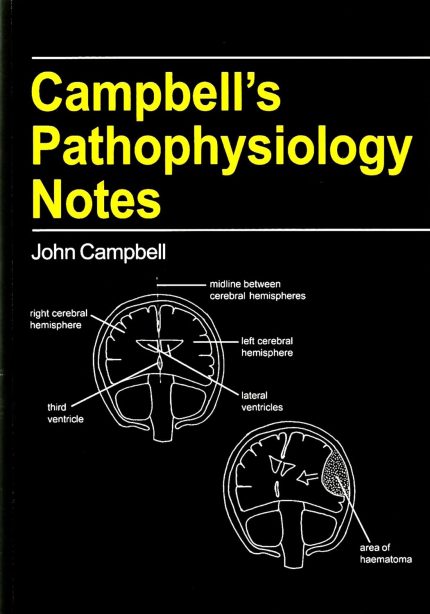 Campbell's Pathophysiology Notes (Campbell's Notes)