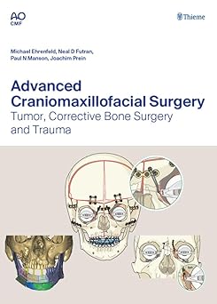 Advanced Craniomaxillofacial Surgery: Tumor, Corrective Bone Surgery, and Trauma