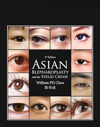Asian Blepharoplasty and the Eyelid Crease