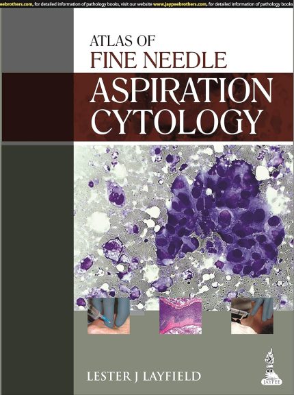 Atlas of Fine Needle Aspiration Cytology