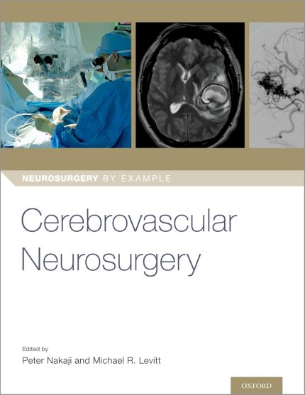 Cerebrovascular Neurosurgery (Neurosurgery by Example)