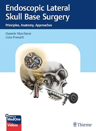 Endoscopic Lateral Skull Base Surgery: Principles, Anatomy, Approaches (without videos)