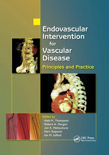 Endovascular Intervention for Vascular Disease Principles and Practice