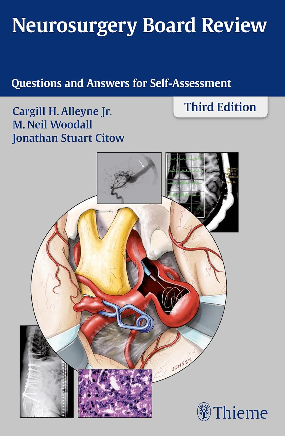 Neurosurgery Board Review: Questions and Answers for Self-Assessment