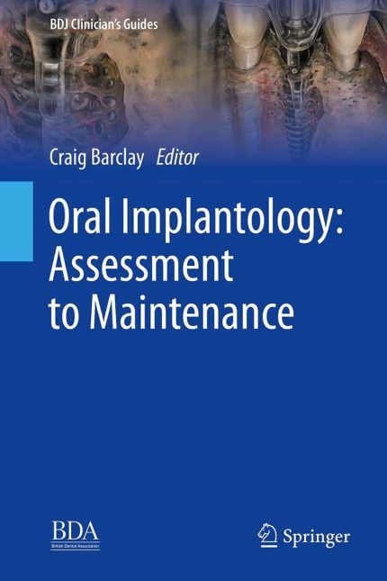 Oral Implantology: Assessment to Maintenance (BDJ Clinician’s Guides)