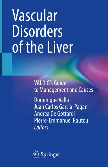 Vascular Disorders of the Liver PDF